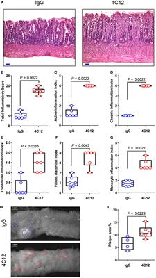 Death Receptor 3 Signaling Controls the Balance between Regulatory and Effector Lymphocytes in SAMP1/YitFc Mice with Crohn’s Disease-Like Ileitis